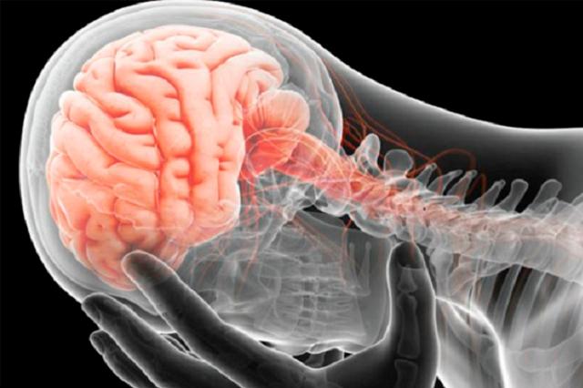 ¿Cuánto tiempo se puede sobrevivir tras un derrame cerebral?
