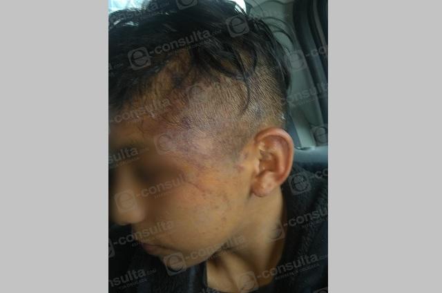 Menor de edad sufre golpiza por parte de policías de Huauchinango