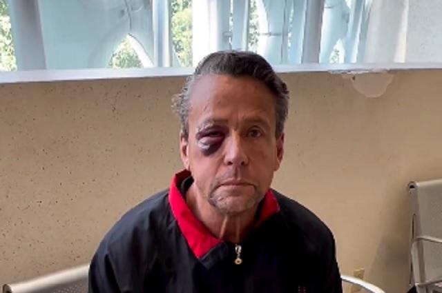 Alfredo Adame revela que lo golpearon con una piedra en el rostro