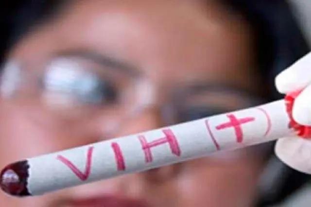 Por VIH atienden en Puebla a más de 4 mil personas